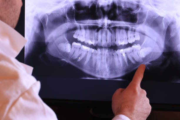 Best Pediatric Emergency Dentist in Ome, GA